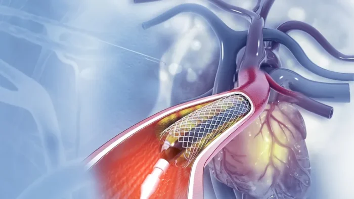 Anjiyo İşlemi: Kasık mı, Bilek mi? Hangisi Daha Güvenli?