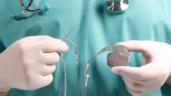 ICD ve Kalp Pili Arasındaki Farklar ve Kullanım Alanları