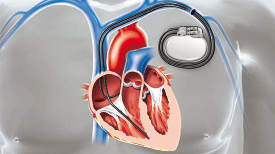 ileri yaşta kalp yetmezliği tedavisi