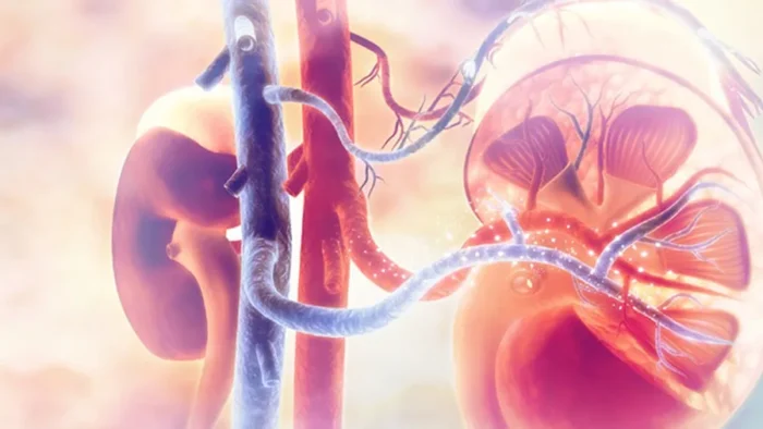 Renal Denervasyon Nedir? Dirençli Hipertansiyonda Yeni Tedavi Seçeneği