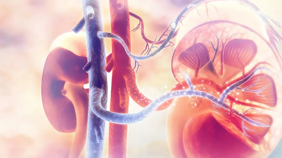 Renal Denervasyon Nedir