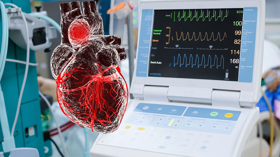 aort anevrizması ve diseksiyonu