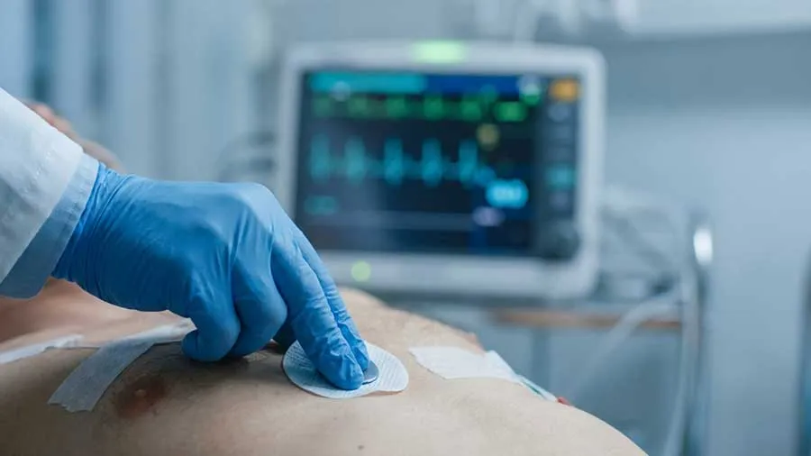 ekg