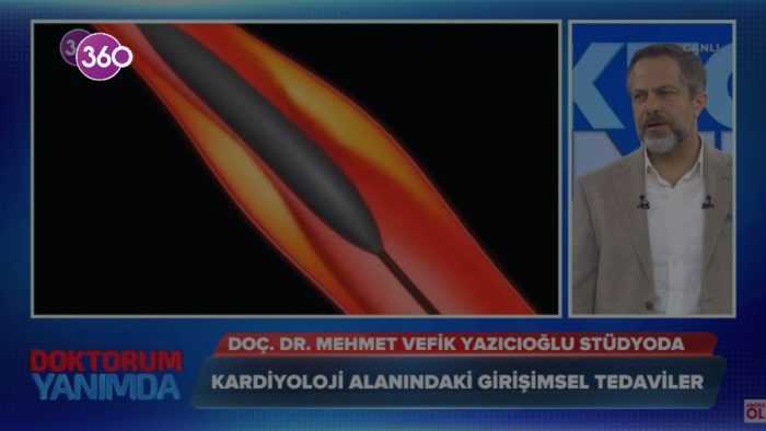 Anjiyo Nedir, Nasıl Yapılır?